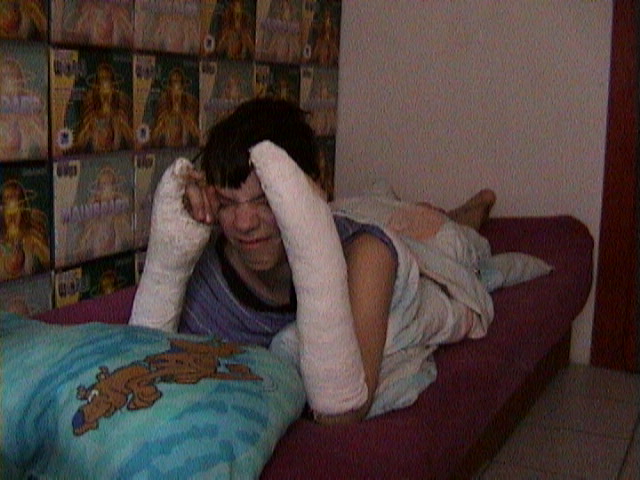 Michal's broken hands... (April 2002)