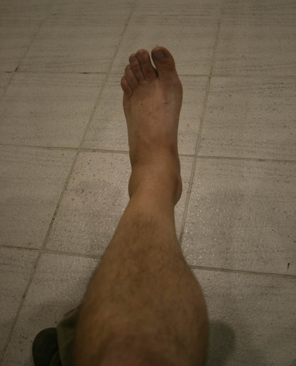 Story of Katka's Foot picture 21024